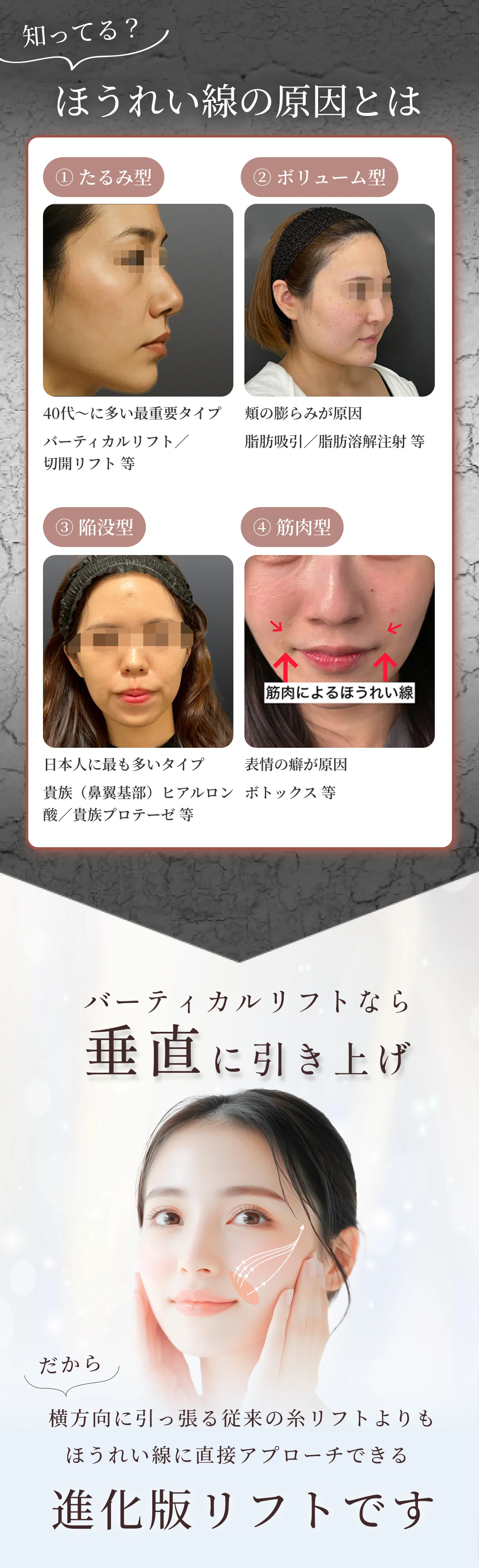 バーティカルリフト